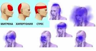 лечение на силно главоболие и причини