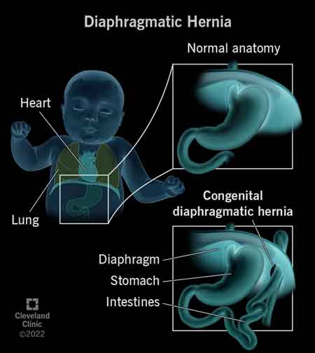 diafragma-diaphragm-06