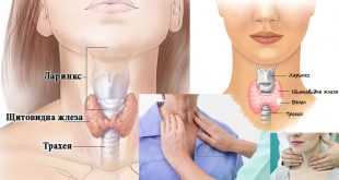 народно лечение на щитовидна жлеза или гуша