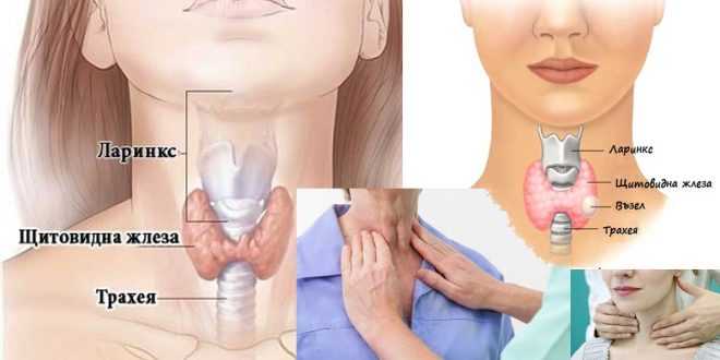народно лечение на щитовидна жлеза или гуша