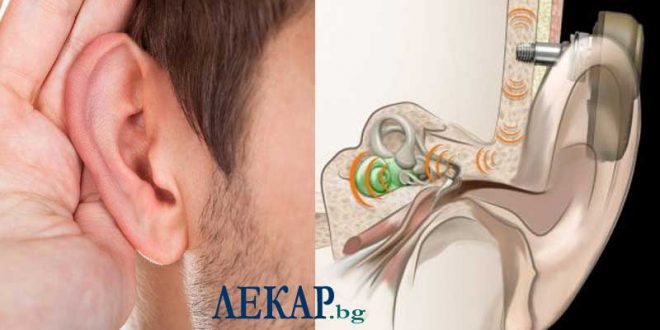 Как се осъществява лечение на намален слух и на глухота.