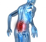Дископатия или дискова херния е наименованието на заболяване на гръбначния стълб