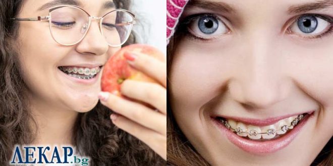 Кои са най-добрите ортодонти в България