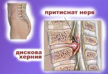 Ердинч Топал, основател на TOPAL Center в София, разказва как лечението на дискова херния без лекарства и хирургия е напълно възможно