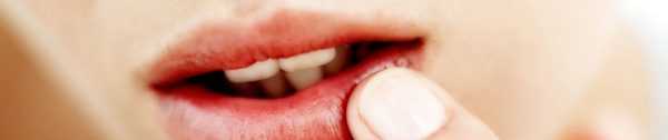 Успешното лечение на херпес на устата зависи от бързата реакция 
