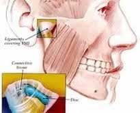артрит на челюстта