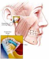 Хомеопатия при артрит на челюстта