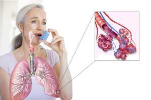 вентолин астма