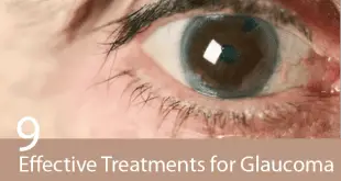 ефективно лечение на глаукома