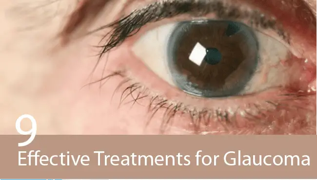Какво е глаукома, кой боледува и как се лекува