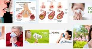 алергична астма