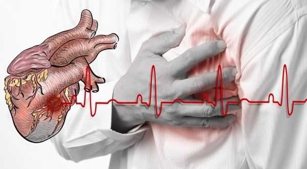продължителност на живот след инфаркт