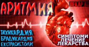 аритмия на сърцето тахикардия брадикардия екстрасистоли сърцебиене