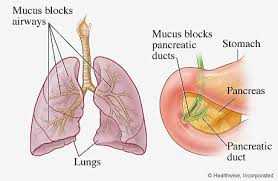 Белият дроб и панкреаса, червата и черният дроб са засегнати от болестта