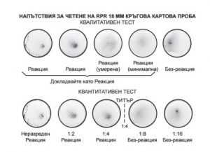 Васерман - тест за сифилис