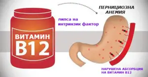Пернициозна анемия (мегалобластна) витамини