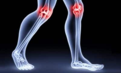 Болки в краката и ставни заболявания, свързани с щракане