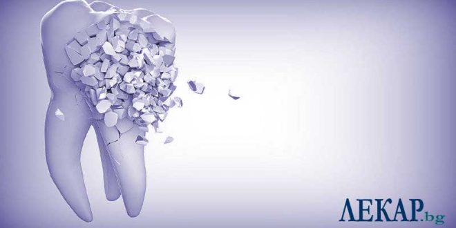 зъбни импланти - 01 zabni-implanti-zaben-kamak_n